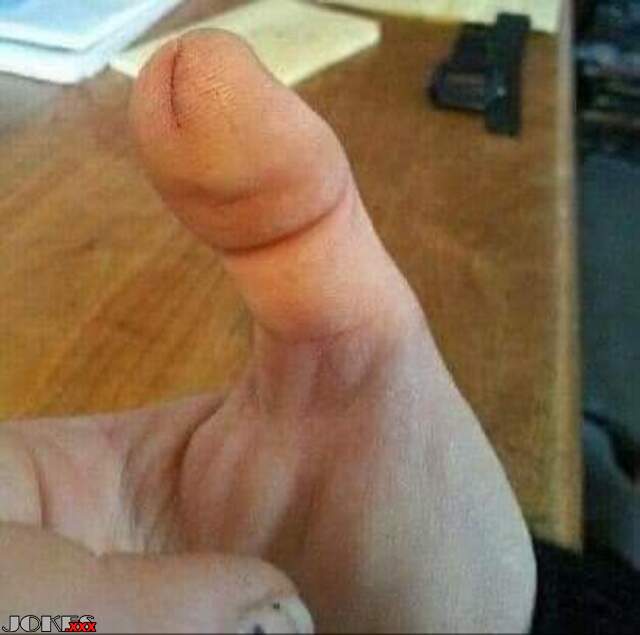 Cut my thumb
